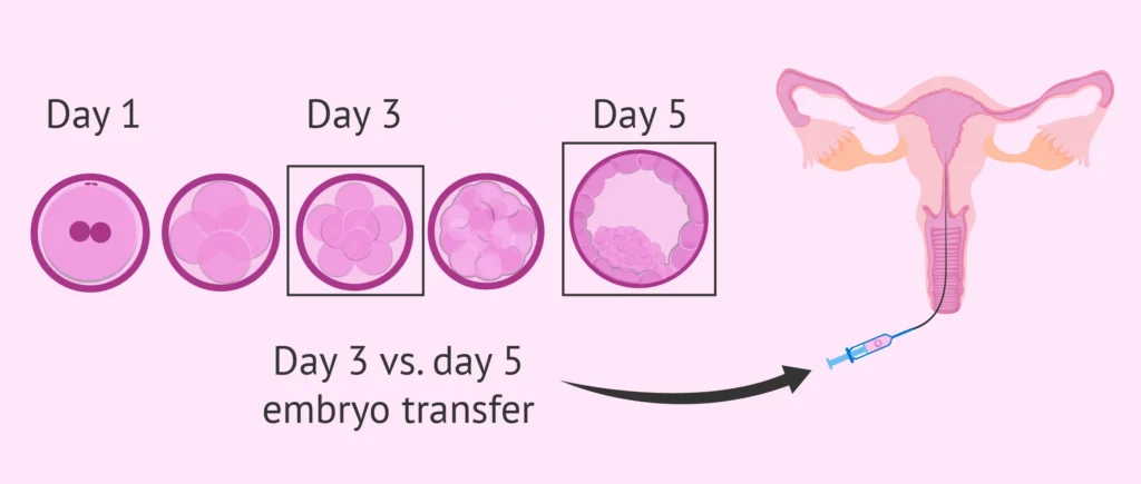 Day 3 Embryo Transfer